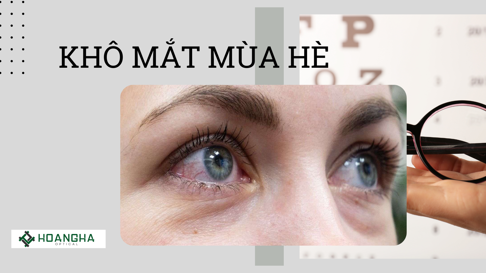 Khô Mắt Vào Mùa Hè