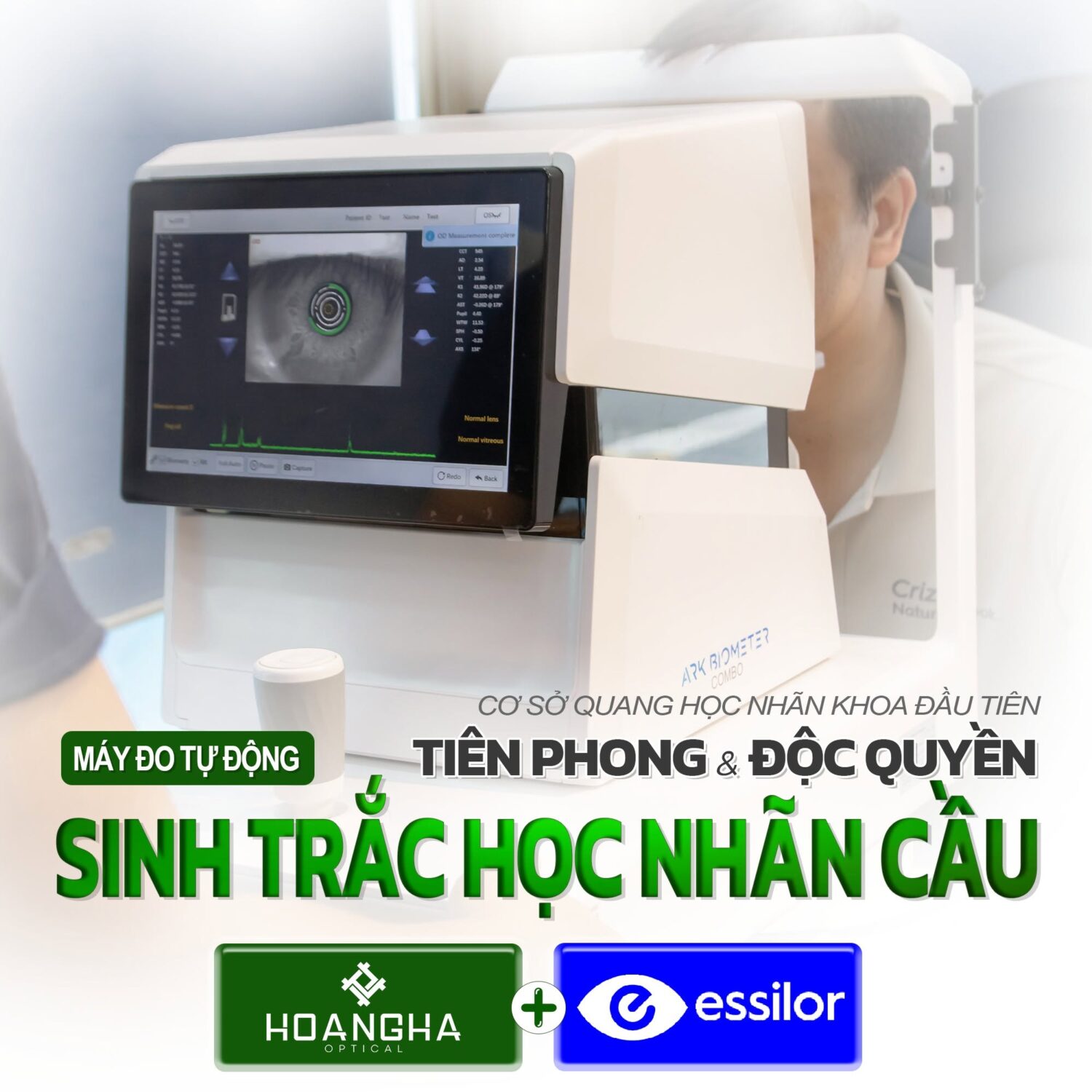 Máy đo sinh trắc học nhãn cầu ARK Biometer Combo (ABC) 4 may do sinh trac hoc nhan cau essilor ark biometer combo abc